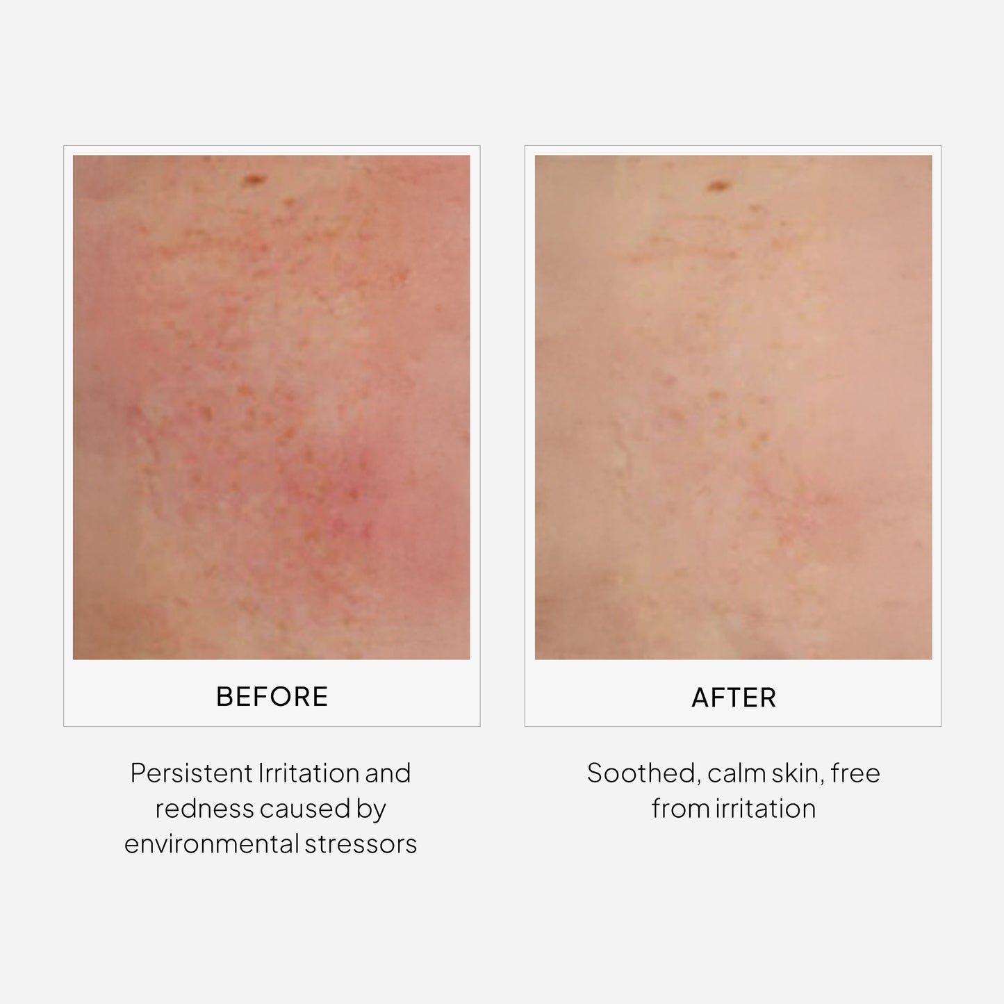 EpiShield Day Serum