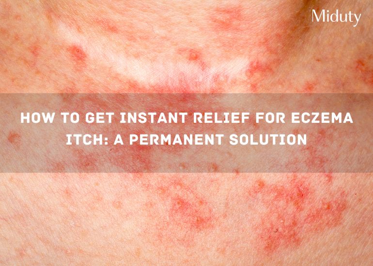 Close-up of skin with eczema showing redness and irritation