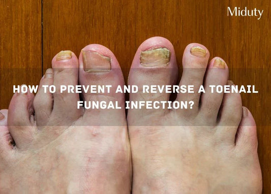 Close-up of toes with signs of fungal infection and peeling nails on a wooden surface