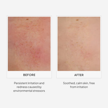EpiShield Day Serum