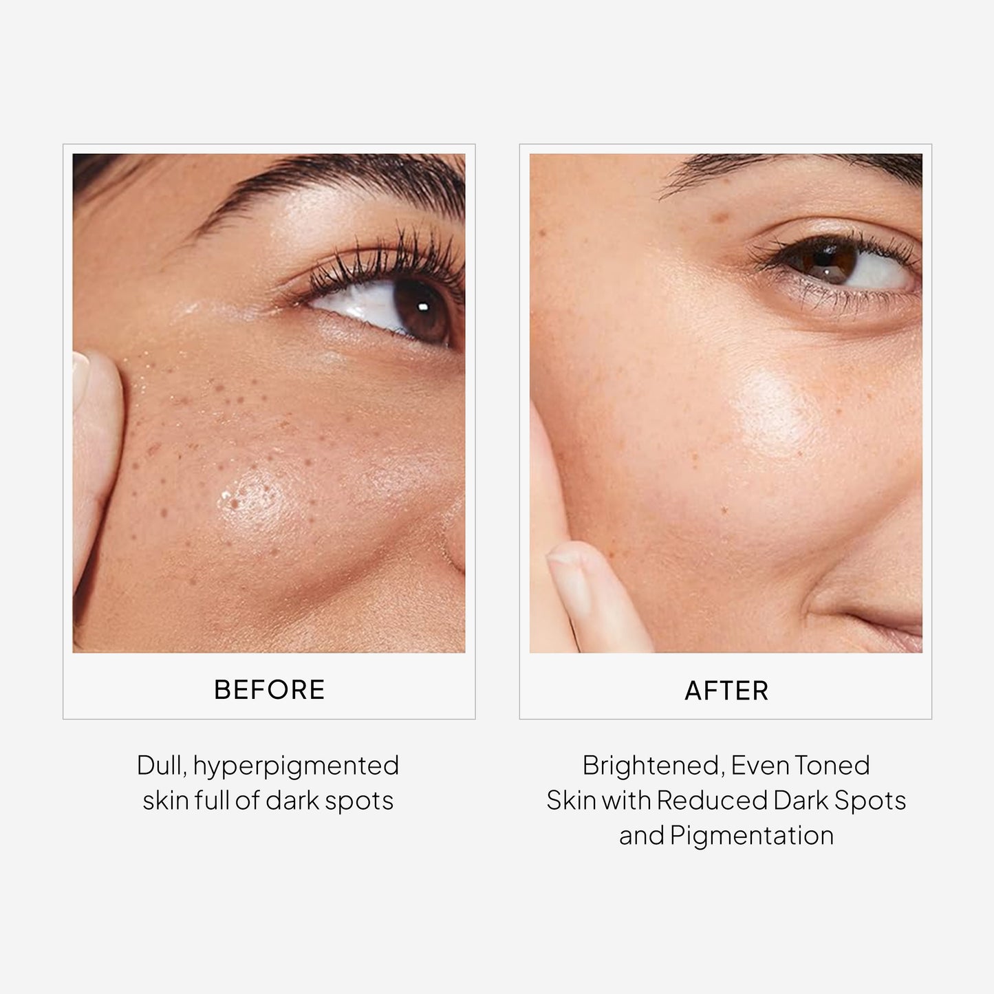 Epilight Night Serum